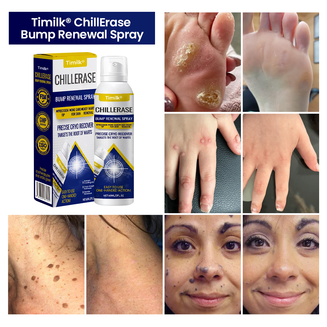 Timilk ChillErase® Bump Renewal Spray