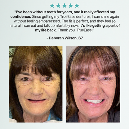 TrueEase™ Custom-Fit Full Functional Dentures